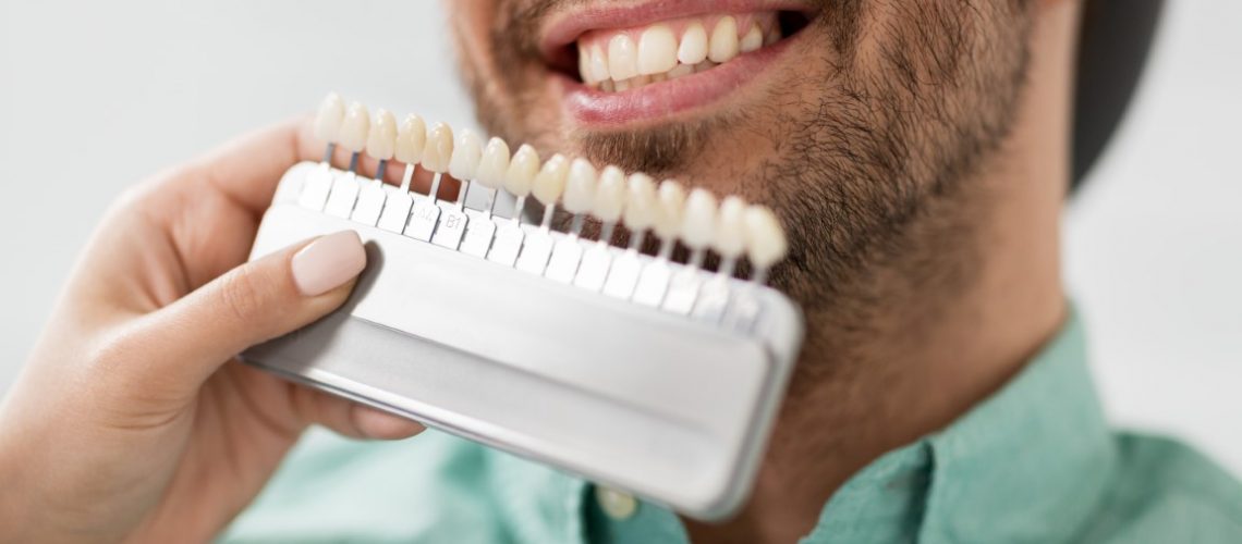 medicine, dentistry and healthcare concept - close up of dentist with tooth color samples choosing shade for male patient teeth at dental clinic